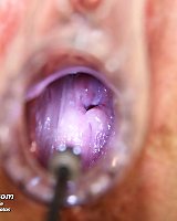 Mature Romana Gynochair Pussy Speculum Examination By Gyno Doctor